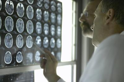 X-rays