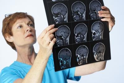 Doctor looking at MRI.
