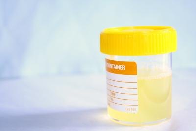 Urine in cup.