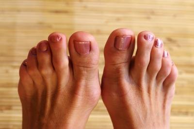 People with peripheral neuropathy might have numbness of the skin, especially in the feet and toes.