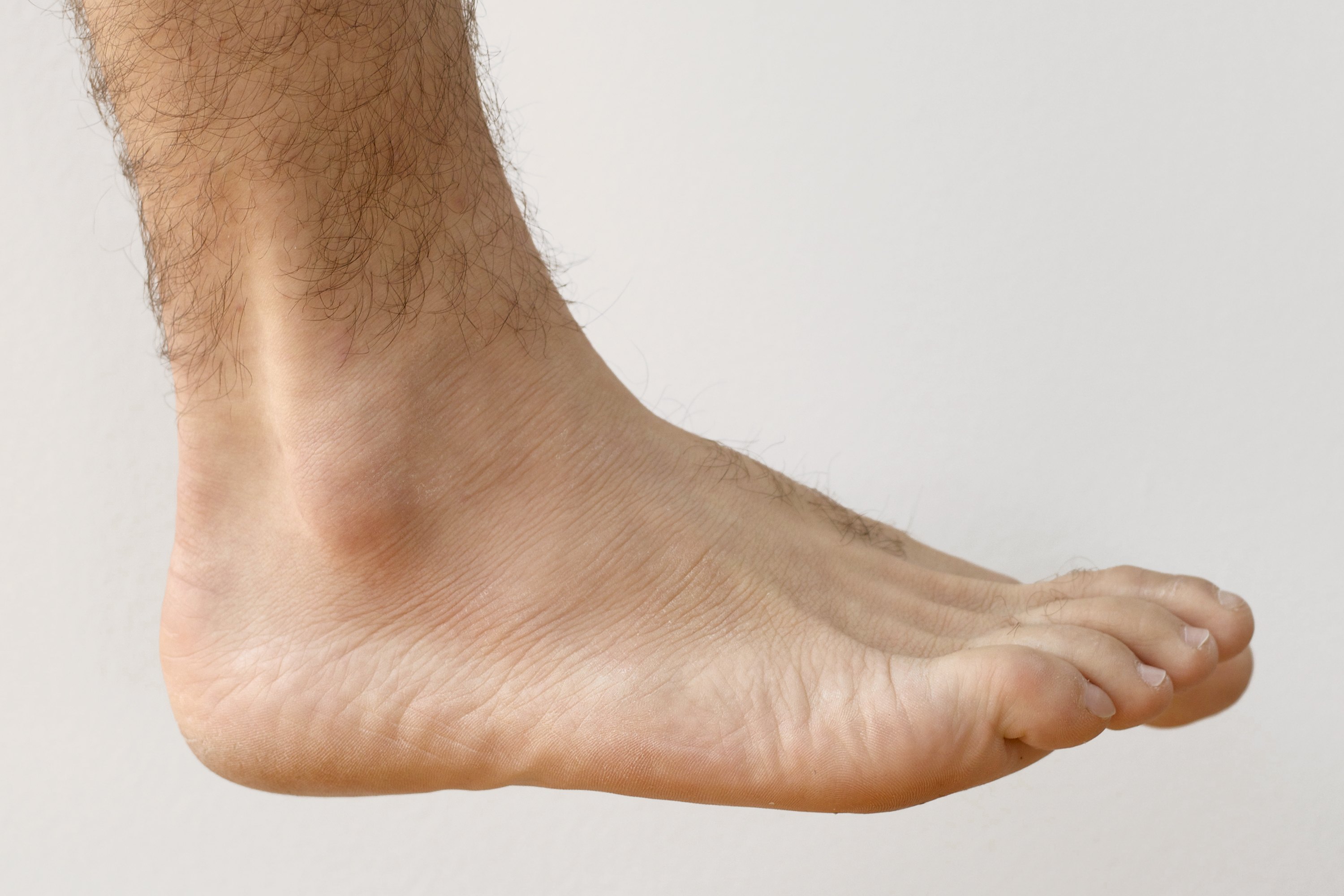 Can You Exercise With A Torn Ankle Ligament