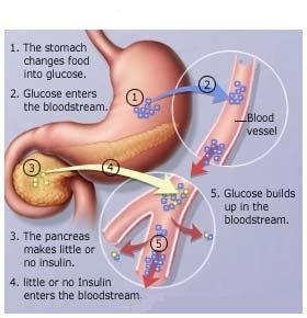 Tell if You have diabetes Tell if You have diabetes