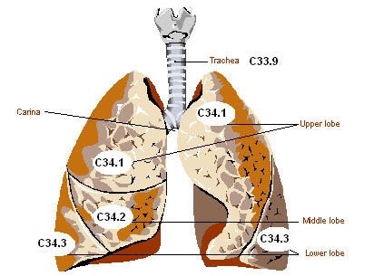 List of Pulmonary Diseases List of Pulmonary Diseases