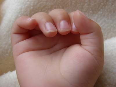 Gomiometry aids in determining if a body part can move to its maximum potential. Gomiometry aids in determining if a body part can move to its maximum potential.