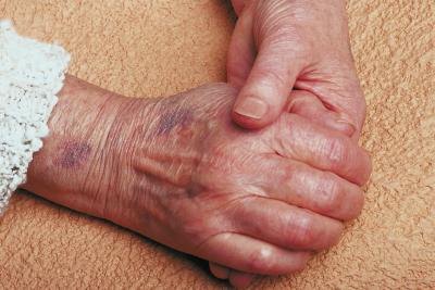 Elderly woman's hands Elderly woman's hands
