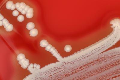 Staphylococcus aureus in petri dish. Staphylococcus aureus in petri dish.