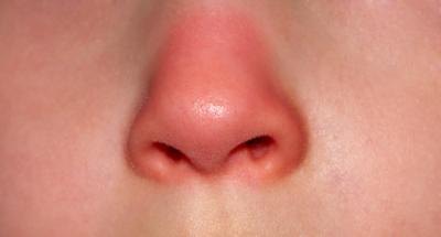A red nose. A red nose.