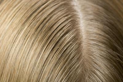Close up of scalp. Close up of scalp.