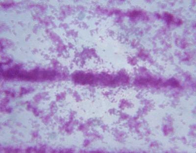 Microscopic view of Tuberculosis. Microscopic view of Tuberculosis.