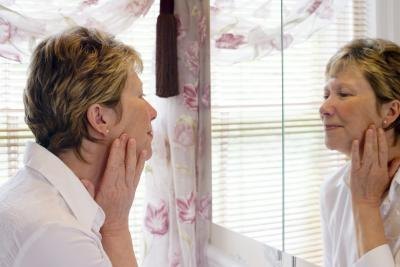 Rosy cheeks don't always indicate rosacea Rosy cheeks don't always indicate rosacea