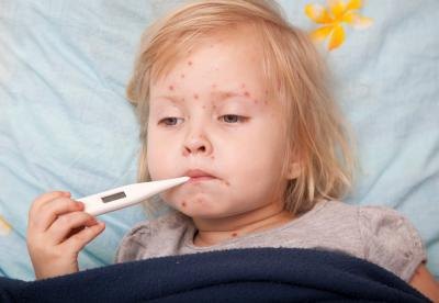 Young girl with chickenpox. Young girl with chickenpox.