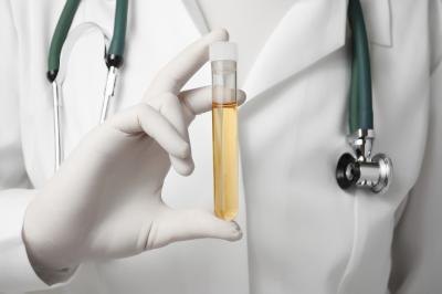 Doctor holding urine sample Doctor holding urine sample