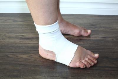 Swelling in the legs is also know as edema. Swelling in the legs is also know as edema.