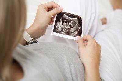 Woman holding ultrasound photo Woman holding ultrasound photo