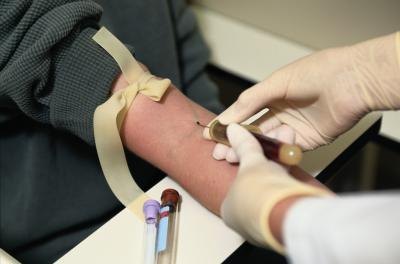 Blood test Blood test