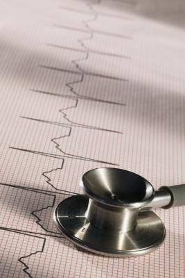 An EKG is used to collect information on your heart rate. An EKG is used to collect information on your heart rate.