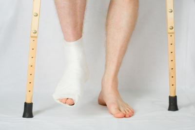 How to recover from broken ankle surgery. How to recover from broken ankle surgery.