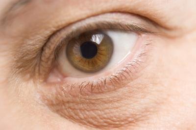 Dark circles under the eyes happen often. Dark circles under the eyes happen often.