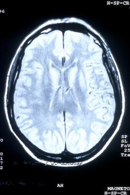 Brain scan Brain scan