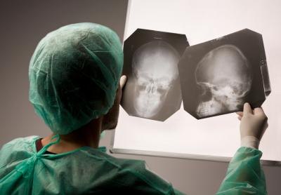 Doctor examines head x-rays. Doctor examines head x-rays.