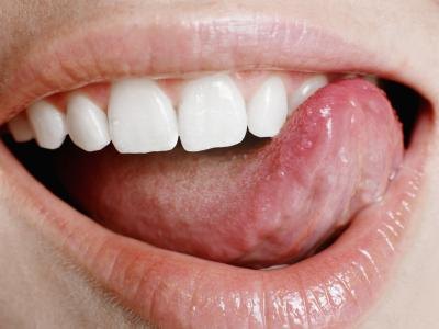 What Causes Lie Bumps On The Tongue: Treatment For Painful ...
