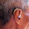 Market Limitations Within the Hearing Aid Industry