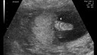 The Highest-Paid Sonographer Specialties | Chron.com