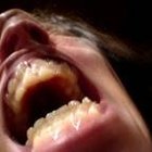 Signs of Verbal Abuse