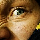 Is Proactive Too Strong for Sensitive Skin?