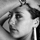 Dry Itchy Scalp Due to Hair Coloring