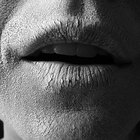 What Is Eucerin Cream?