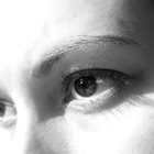 How to Cure Dark Circles
