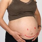 Es Posible Quedar Embarazada Con Ligadura De Trompas Mira