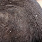 Can Any Supplements Help Control Dandruff?