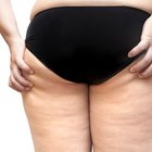 Seaweed Bath & Cellulite