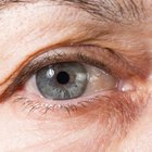 Glucosamine & Wrinkles