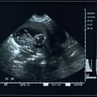 How to Tell My Husband I'm Pregnant a Second Time Around