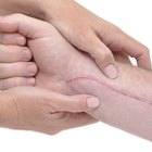 How to Get Rid of Scars With Wheat Germ Oil