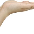 How to Get Rid of a Callous on Your Hand