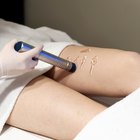 Is Cellulite a Permanent Condition?