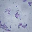 ¿Cómo se reproducen los protistas?