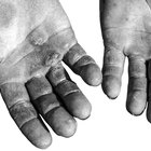 Callus From Pullups