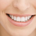 How to Get Your Teeth White in 10 Minutes