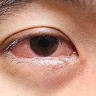 The Side Effects of Sodium Bisulfite