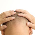 How to Shave Your Own Head With Electric Clippers