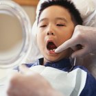 ¿Puedes blanquear los dientes de tus hijos usando tiras de blanqueamiento?