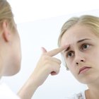 Types of Skin Blemishes