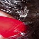 Shampoo for Dry, Flaky Scalp
