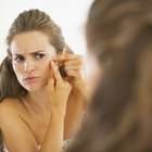 Are There Vitamins That Cause Acne?