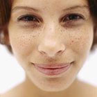 How to Fade Unwanted Freckles